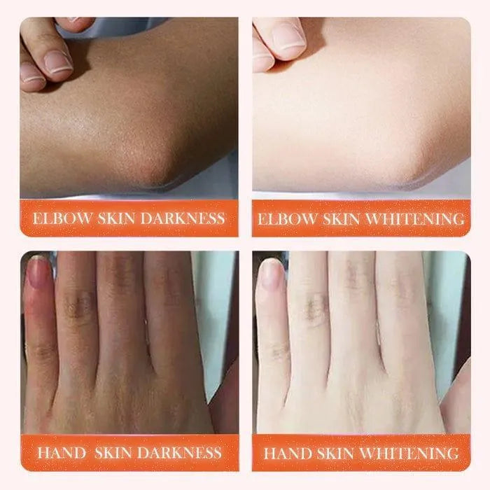 Whitening And Brightening Cream - 150ml Body Lotion for All Skin Types